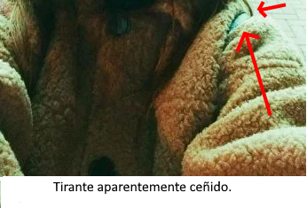Tiranteceñido.png